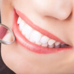 What Enamel Does for Your Teeth Aside from Protecting Them